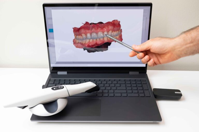 Hoe een 3D-scan jouw prothese-ervaring verbetert
