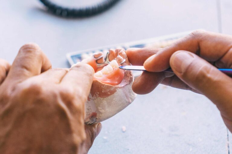Waarom zit mijn kunstgebit ineens los? Oorzaken en oplossingen